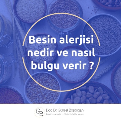 Besin alerjisi nedir ve nasıl bulgu verir ?